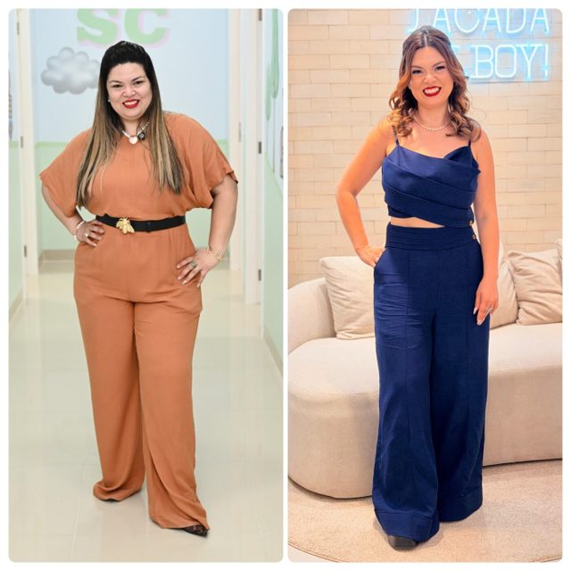 Antes e depois — paciente do Dr. Sérgio Daniel