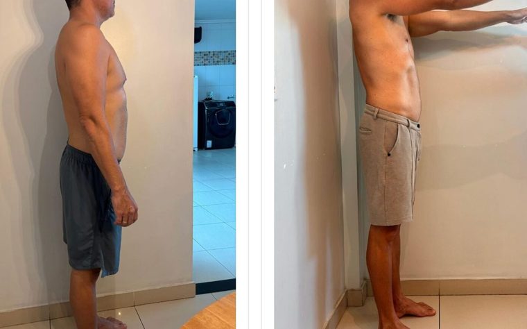 Antes e depois de paciente — Dr. Sérgio Daniel