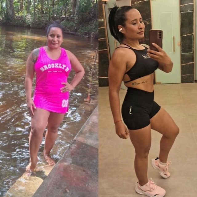 Antes e depois — paciente do Dr. Sérgio Daniel