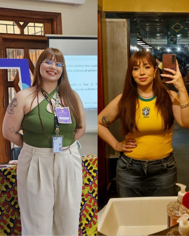 Antes e depois — paciente do Dr. Sérgio Daniel