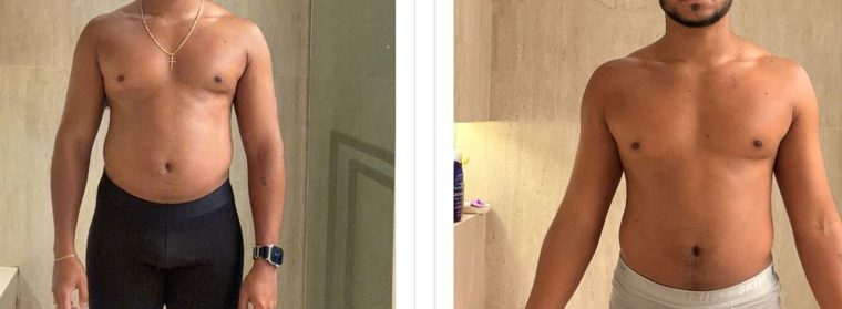 Antes e depois de paciente — Dr. Sérgio Daniel